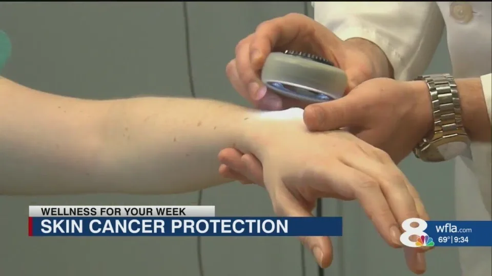 Dr. Alexander Dane on WFLA News Channel 8 explaining winter sun damage protection in Florida